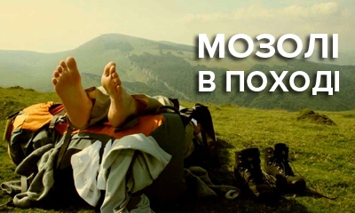 Как предотвратить появление мозолей при беге и в походах, что делать с волдырями