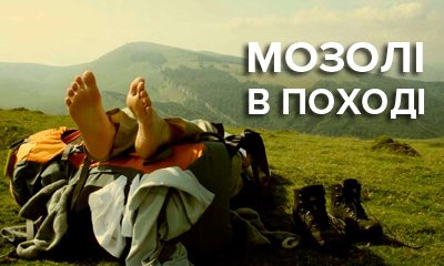 Как предотвратить появление мозолей при беге и в походах, что делать с волдырями